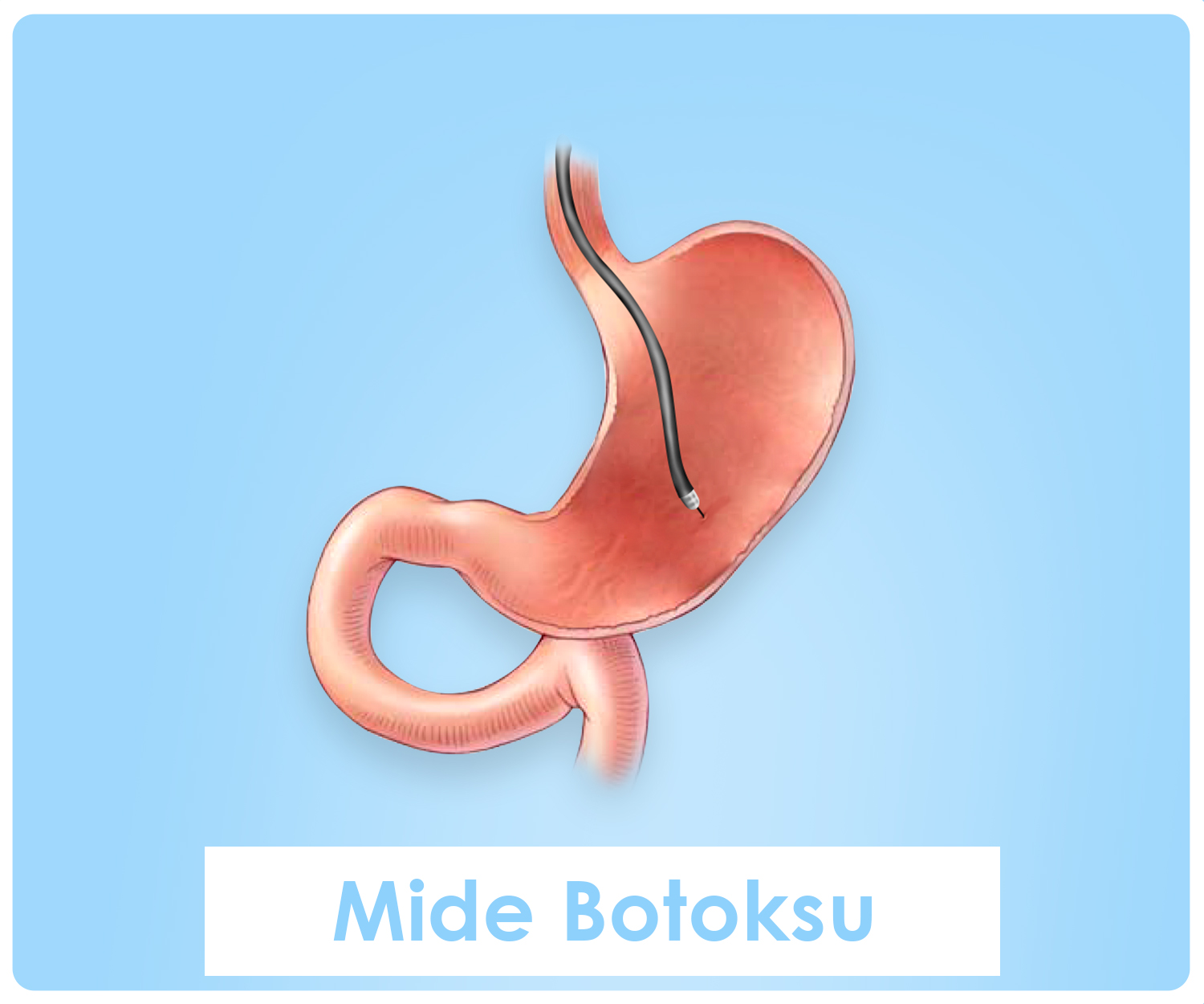 https://drmehmetgencturk.com/wp-content/uploads/2022/03/midebotoksu1.jpg