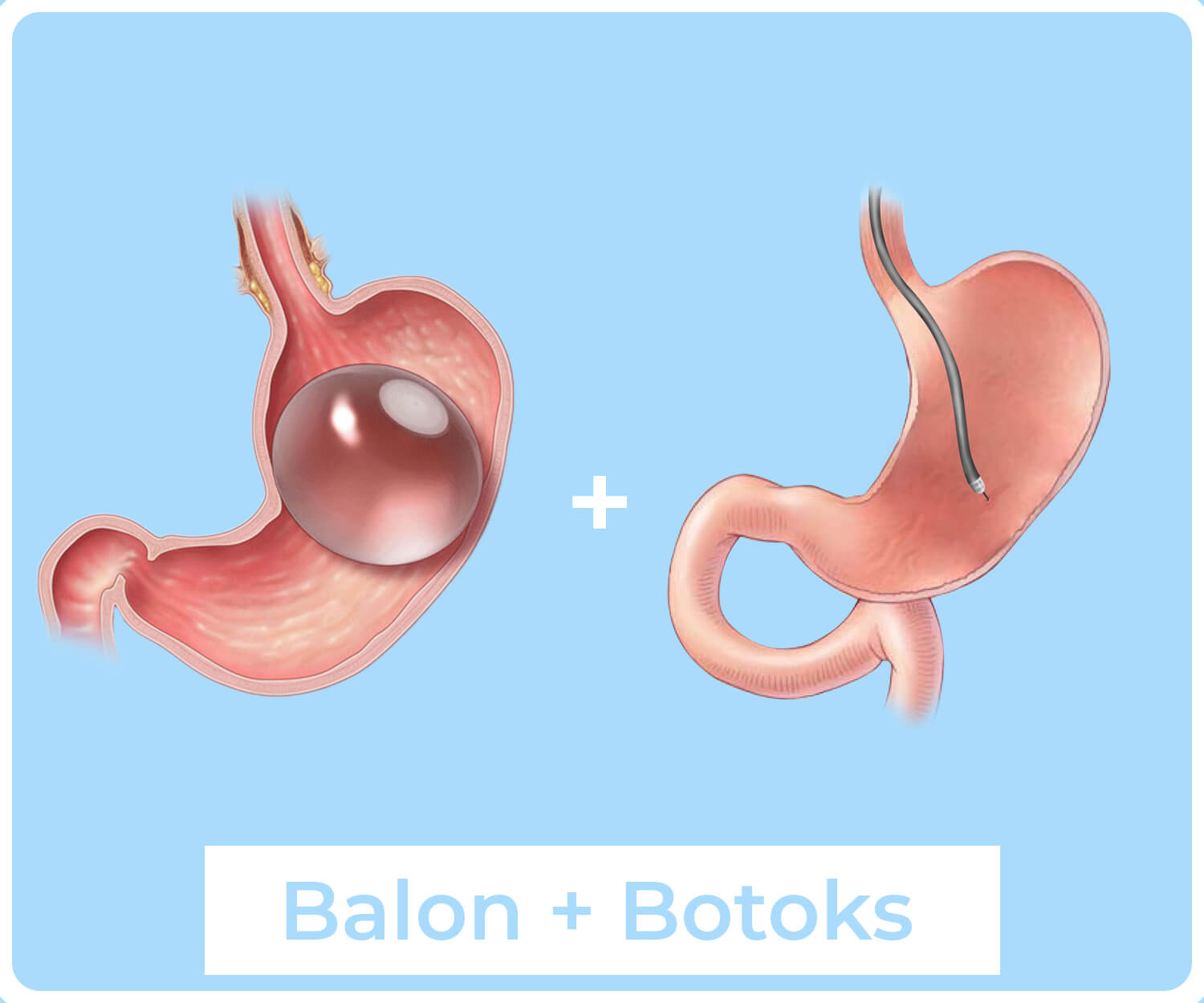 https://drmehmetgencturk.com/wp-content/uploads/2022/05/Balon-Botoks.jpg